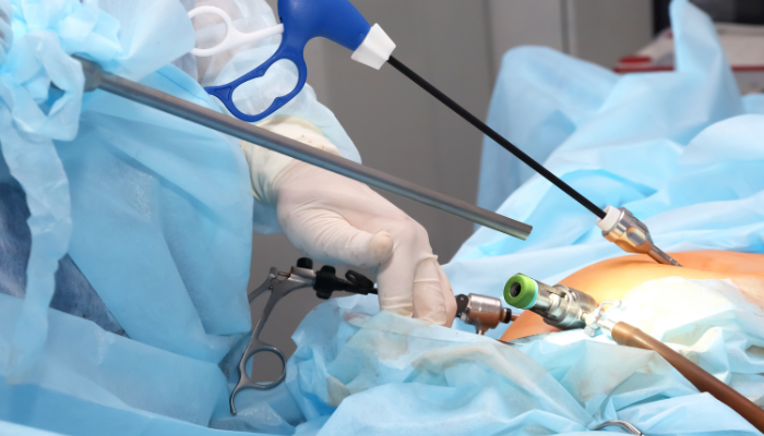 Diagnostic and Operative Laparoscopy